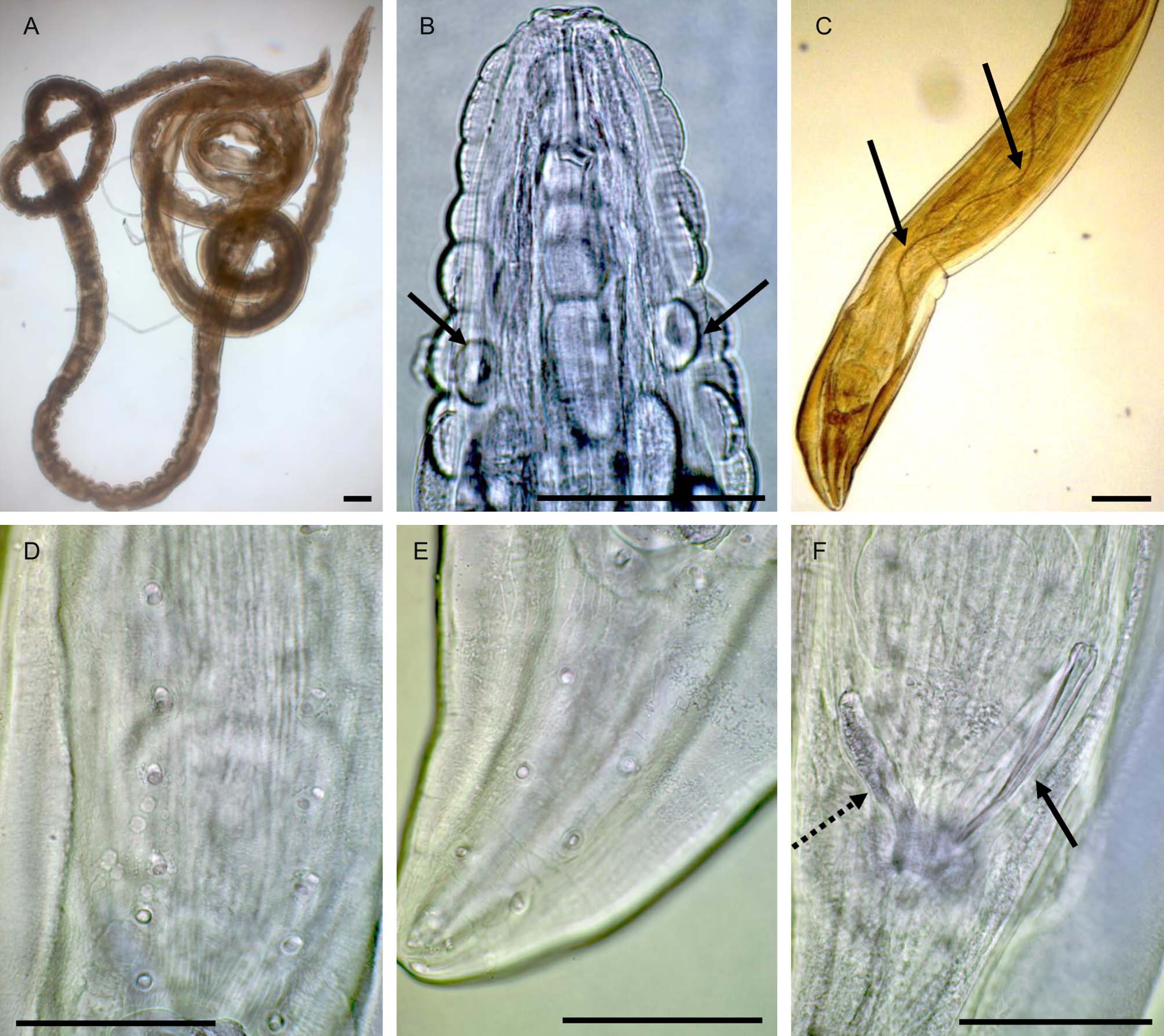 Gongylonema pulchrum (Nematoda), male. Bars: 100 μm. A – entire male. B – cuticular bosses and deirids (arrows). C – posterior end and left spicule (arrows). D – precloacal papillae. E – postcloacal papillae. F – posterior end: right spicule (arrow) and g