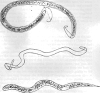 Figure 2. Filaria bancrofti embryo in its sheath, empty sheath, Filaria bancrofti embryo after escaping from its sheath