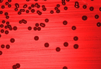 Haemophilus influenzae bacteria cultured on a blood agar plate