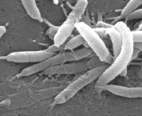 Scanning electron micrograph depicts a grouping of Helicobacter