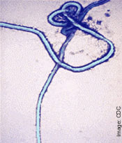 Electronmicrograph of Ebola,