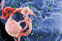 Electronmicrograph of HIV-1 virions (green spheres) budding from a lymphocyte.