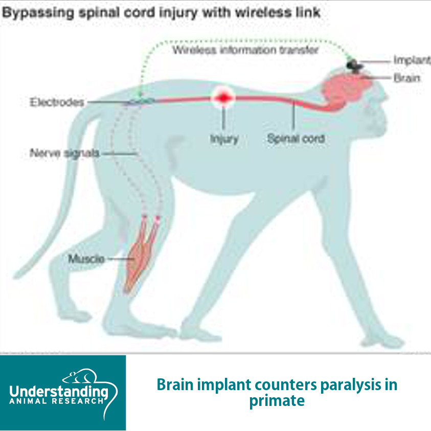 Spinal cord injury  