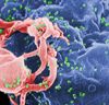 AZT - die erste medikamentöse Therapie für HIV