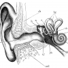 Deafness/hearing loss