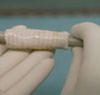 Primo trapianto d'organo intero realizzato con tessuti ingegnerizzati