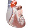 Valvole cardiache artificiali