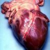 Heart disorders